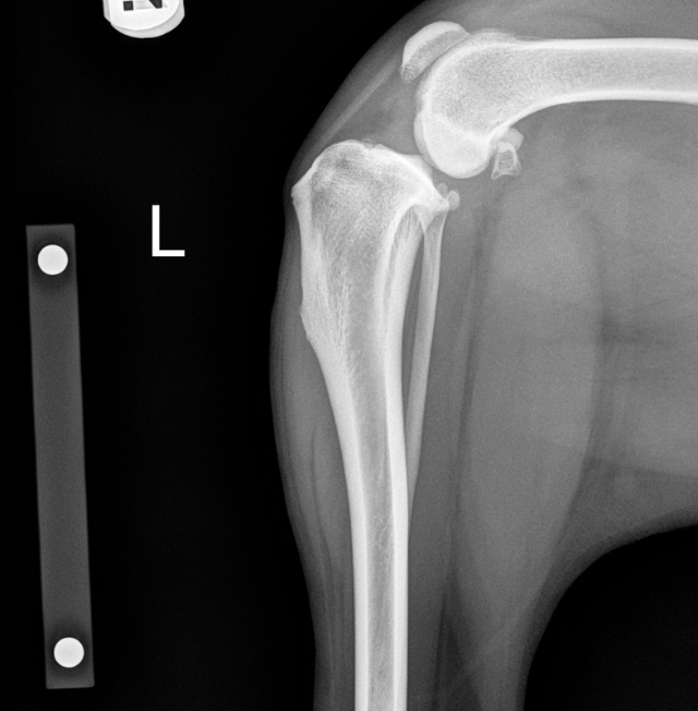 tplo2